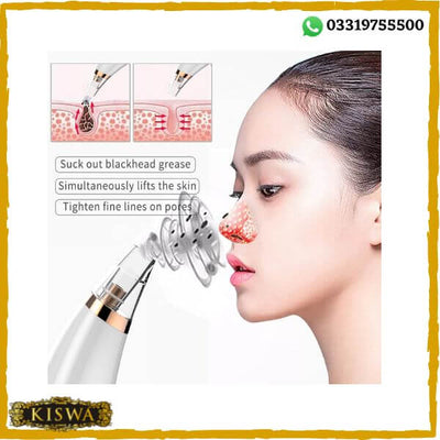 Acne Pore Cleaner & Black Head Remover With Cleaning Tools